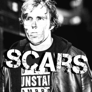 SCARS (Ambrose Playlist)