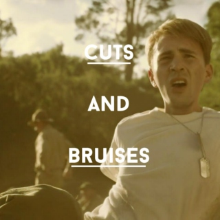 cuts and bruises