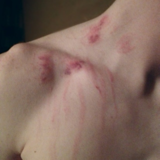 scratches & hickeys