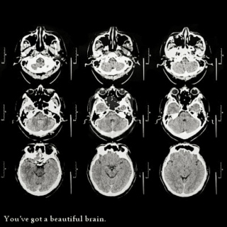 You've got a beautiful brain.