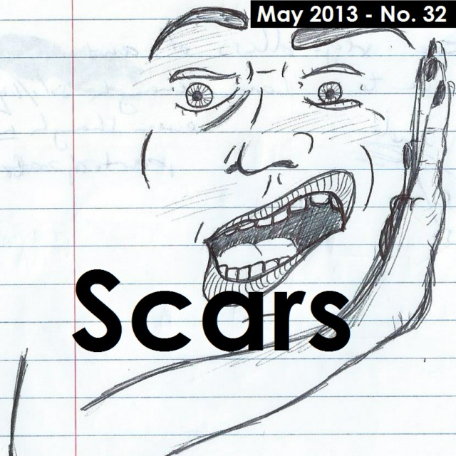 Scars (May 2013)