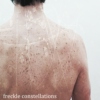 freckle constellations