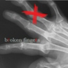 broken fingers 