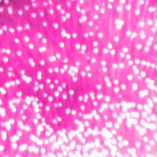 Tiefenrausch #019: Brainpan full of pink snails (part 1)