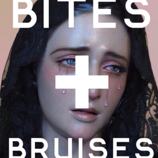 bites & bruises.