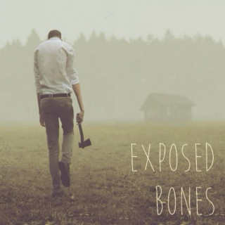 exposed bones